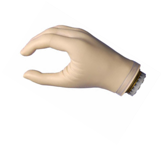 假肢廠家安裝手指假肢時(shí)會遇到哪種問題(圖1) 假肢廠家安裝手指假肢時(shí)會遇到哪種問題(圖1)