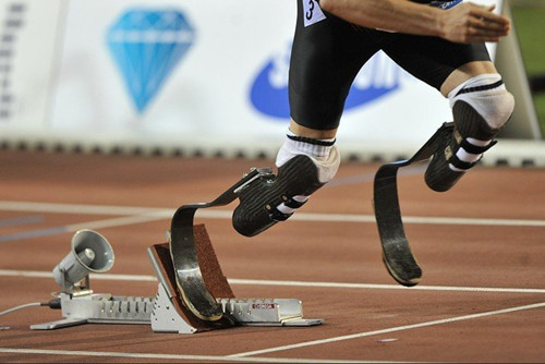 市場一般假肢價格是在多少呢(圖1) 市場一般假肢價格是在多少呢(圖1)