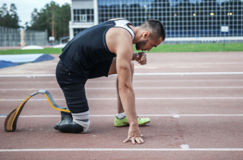 分析假肢價(jià)格比較高的原因是什么(圖1) 分析假肢價(jià)格比較高的原因是什么(圖1)