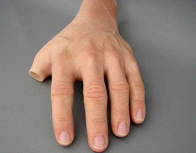 什么樣的殘肢適合安裝假肢河南假肢生產(chǎn)廠家(圖1) 什么樣的殘肢適合安裝假肢河南假肢生產(chǎn)廠家(圖1)