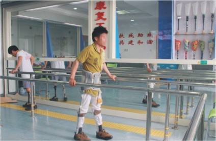 假肢產(chǎn)品價格表,安裝假肢價格貴不貴?(圖1) 假肢價格