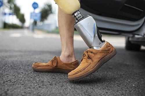 假肢產(chǎn)品價格表,安裝假肢價格貴不貴?(圖2) 假肢價格