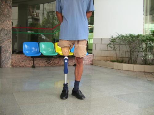 假肢價格的形成需要經(jīng)過哪三個環(huán)節(jié)?(圖2) 假肢價格